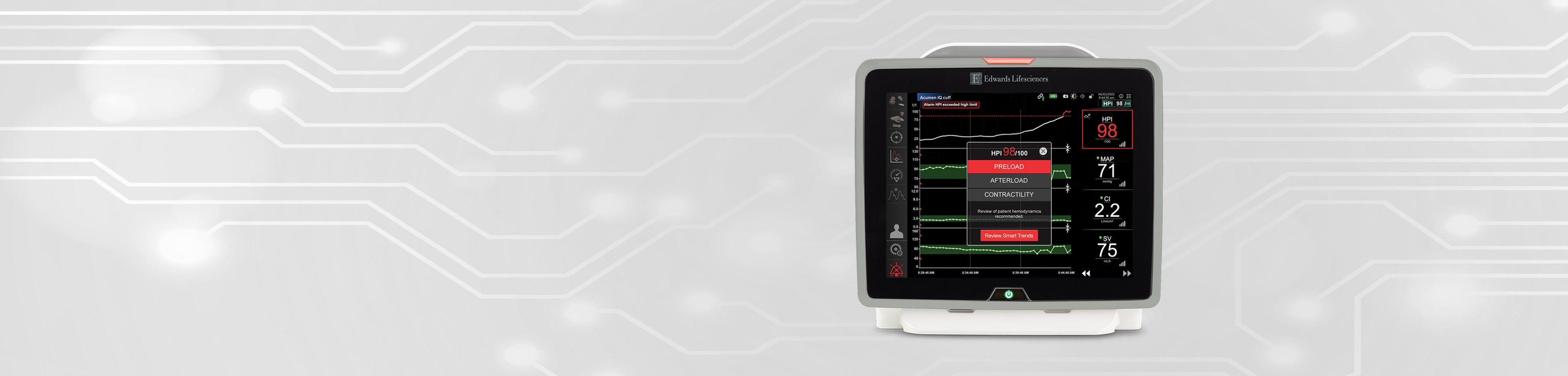 Clinical evidence: Acumen Hypotension Prediction Index (HPI) Software ...
